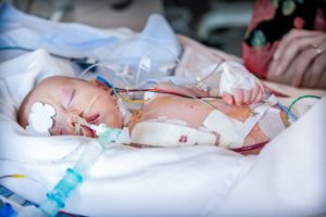 Infant in Intensive Care Unit