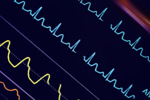 Colorful ECG waves on the hospital monitor